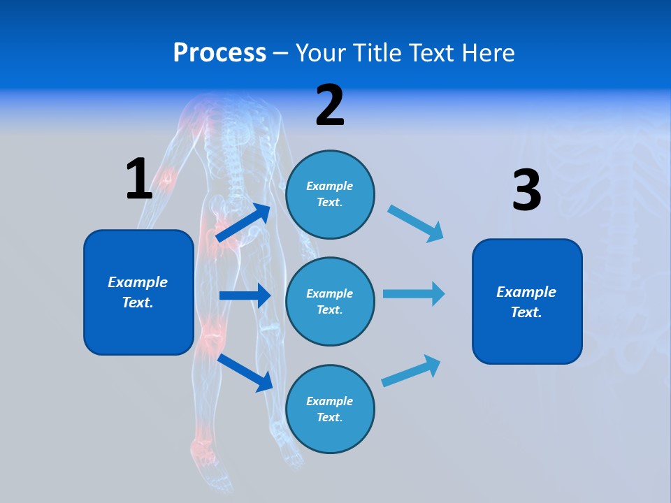 Ilium Painful Osteoporosis PowerPoint Template