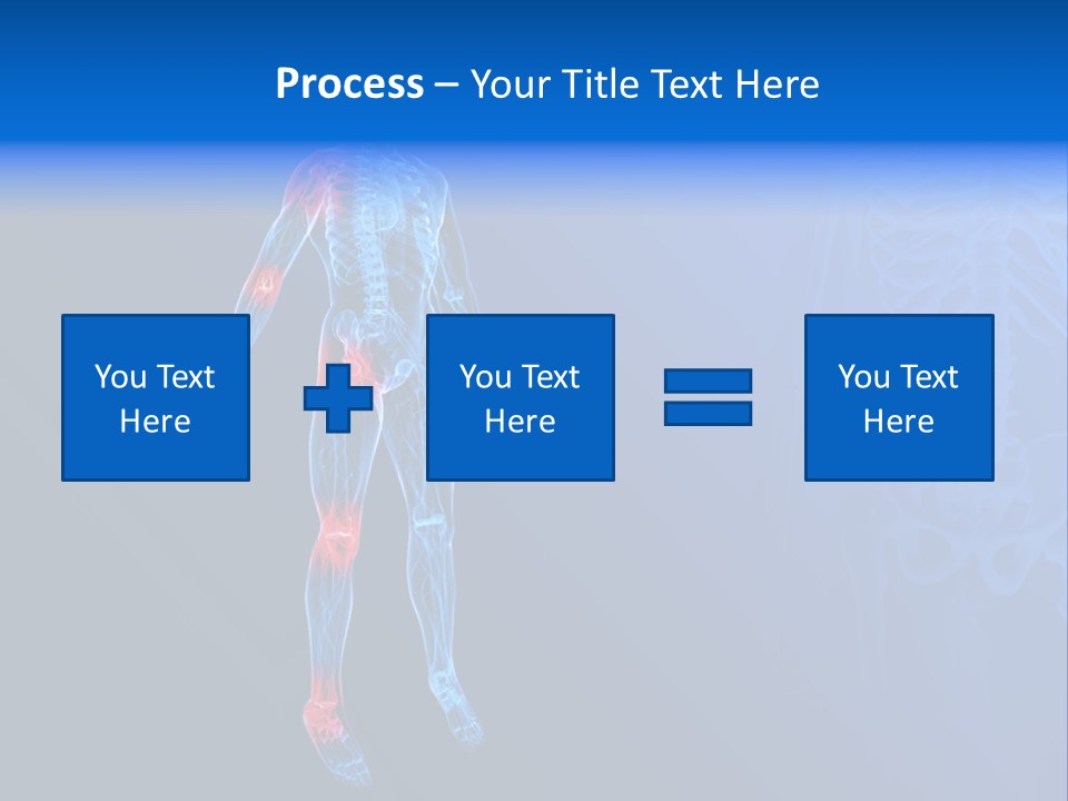 Ilium Painful Osteoporosis PowerPoint Template
