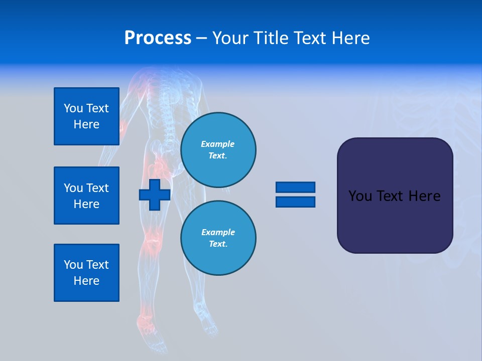 Ilium Painful Osteoporosis PowerPoint Template