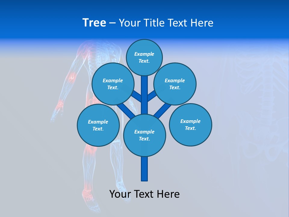 Ilium Painful Osteoporosis PowerPoint Template