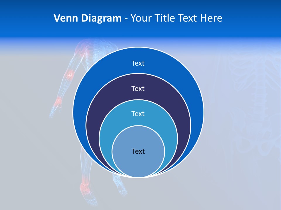 Ilium Painful Osteoporosis PowerPoint Template