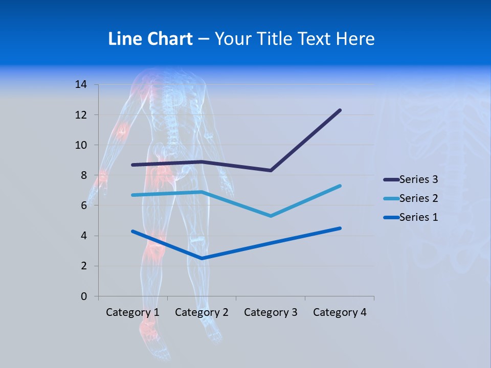 Ilium Painful Osteoporosis PowerPoint Template