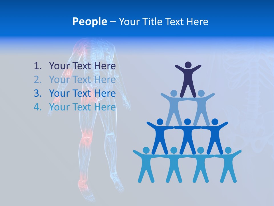Ilium Painful Osteoporosis PowerPoint Template