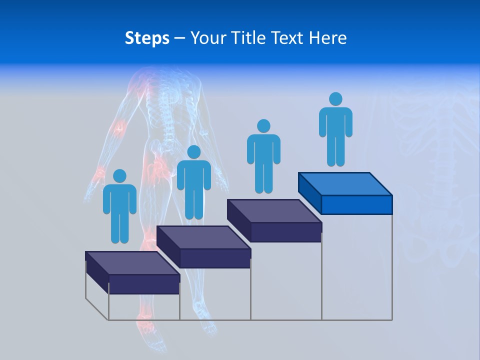 Ilium Painful Osteoporosis PowerPoint Template