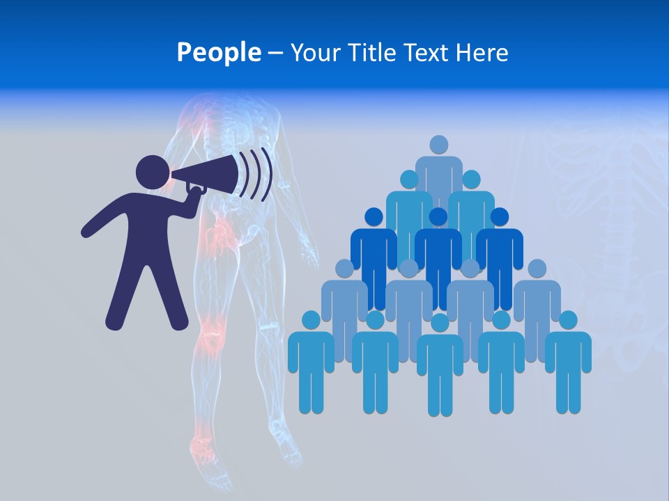 Ilium Painful Osteoporosis PowerPoint Template