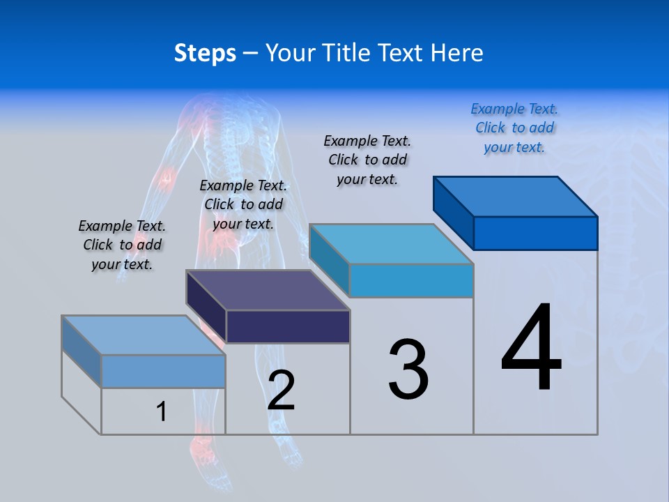 Ilium Painful Osteoporosis PowerPoint Template