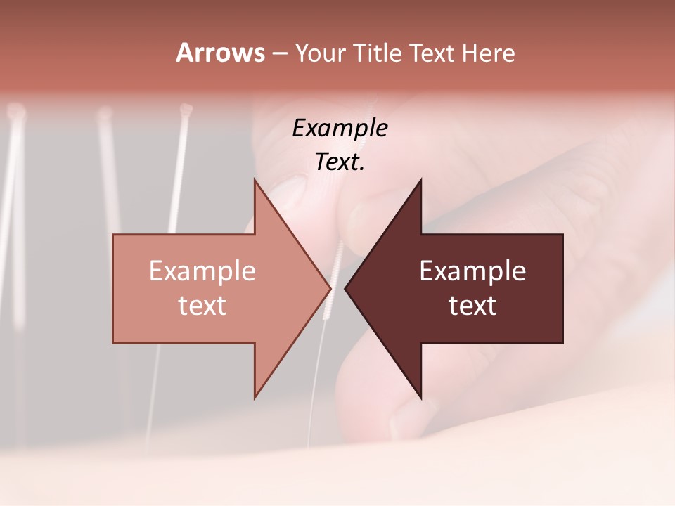 Alternative Puncture Pain PowerPoint Template
