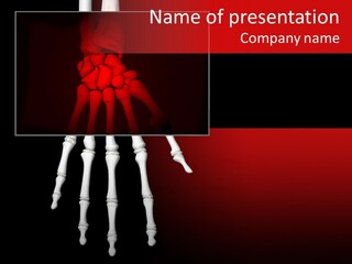 Motion Hand Heal PowerPoint Template