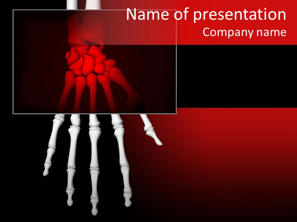 Motion Hand Heal PowerPoint Template