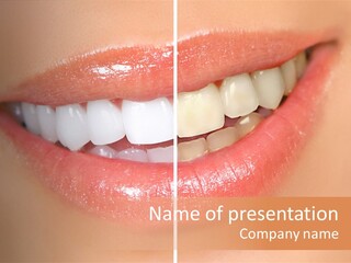 Lips Smile Lady PowerPoint Template