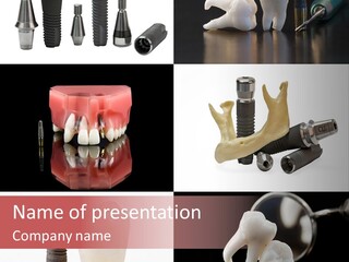 Treatment Accessory Roots PowerPoint Template
