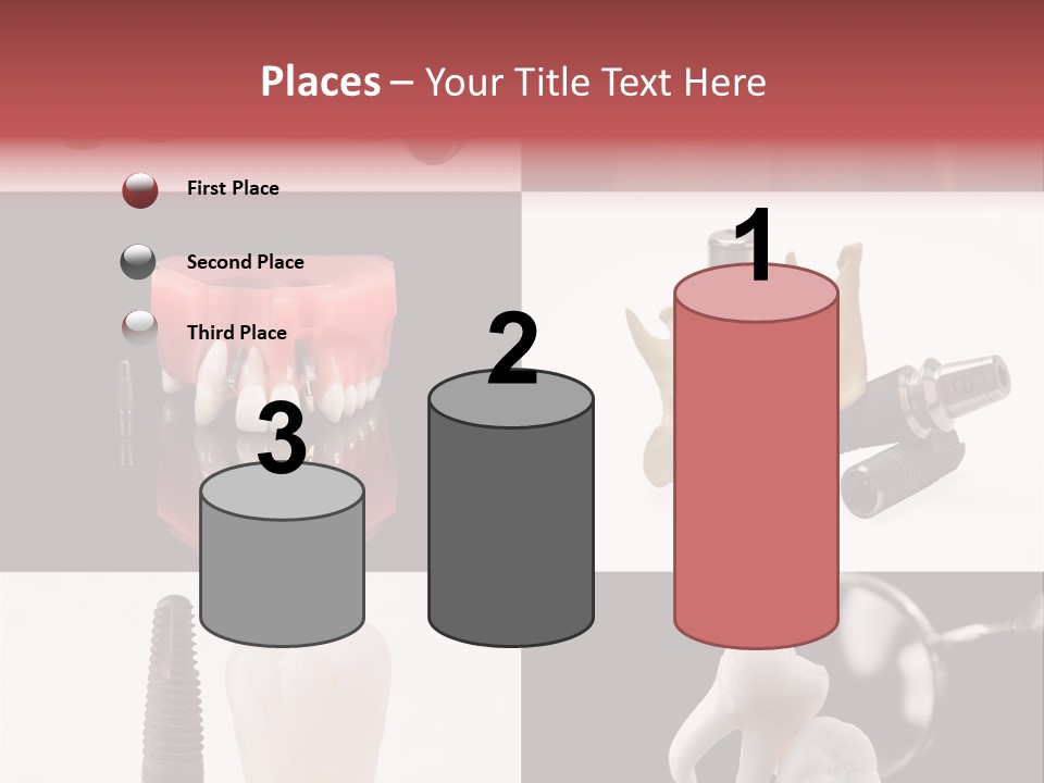 Treatment Accessory Roots PowerPoint Template