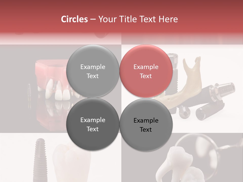 Treatment Accessory Roots PowerPoint Template