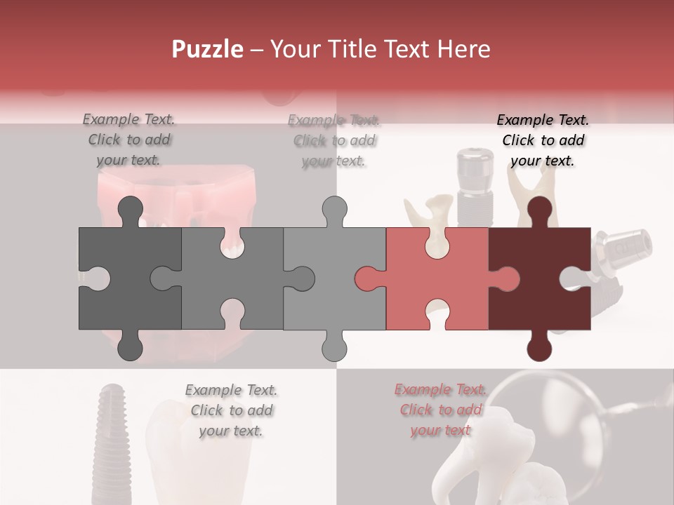 Treatment Accessory Roots PowerPoint Template