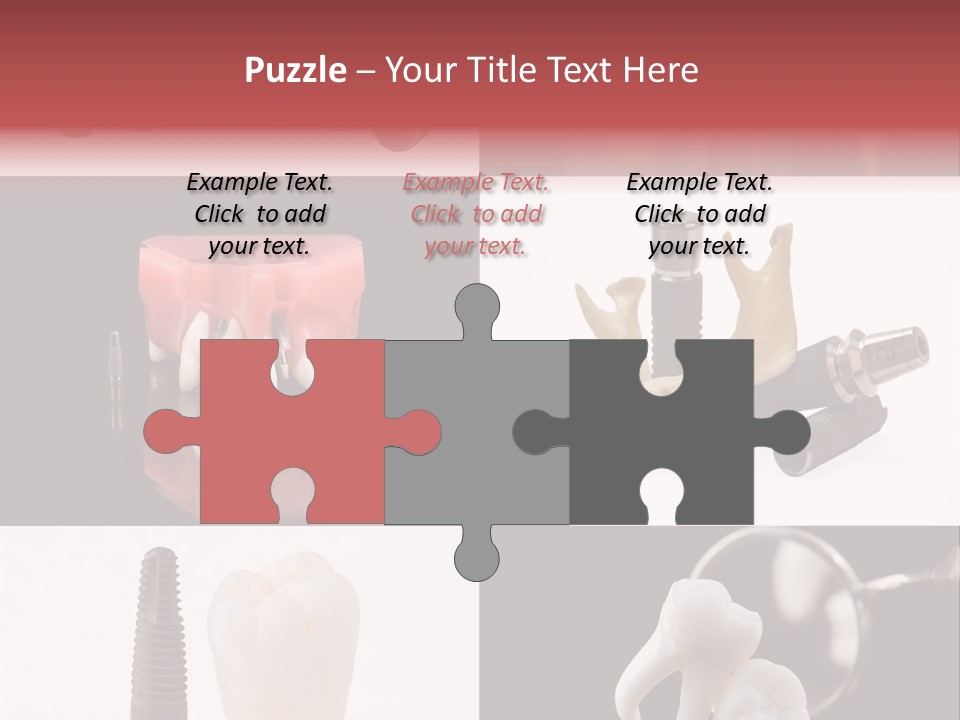 Treatment Accessory Roots PowerPoint Template