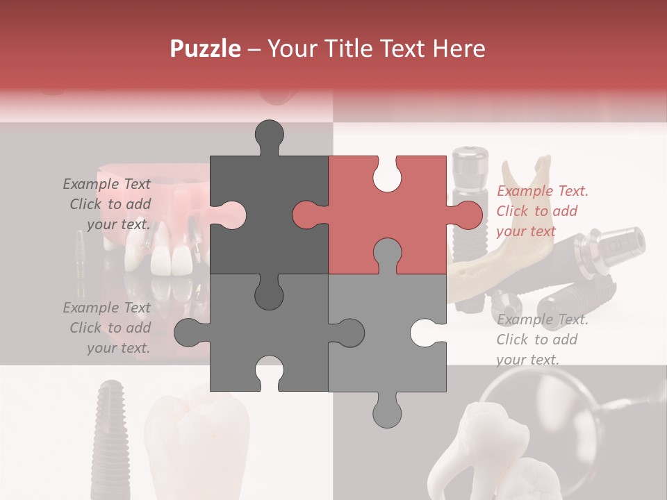 Treatment Accessory Roots PowerPoint Template