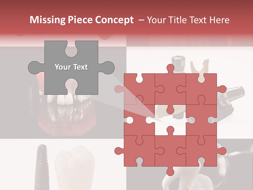 Treatment Accessory Roots PowerPoint Template