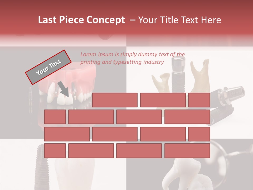 Treatment Accessory Roots PowerPoint Template