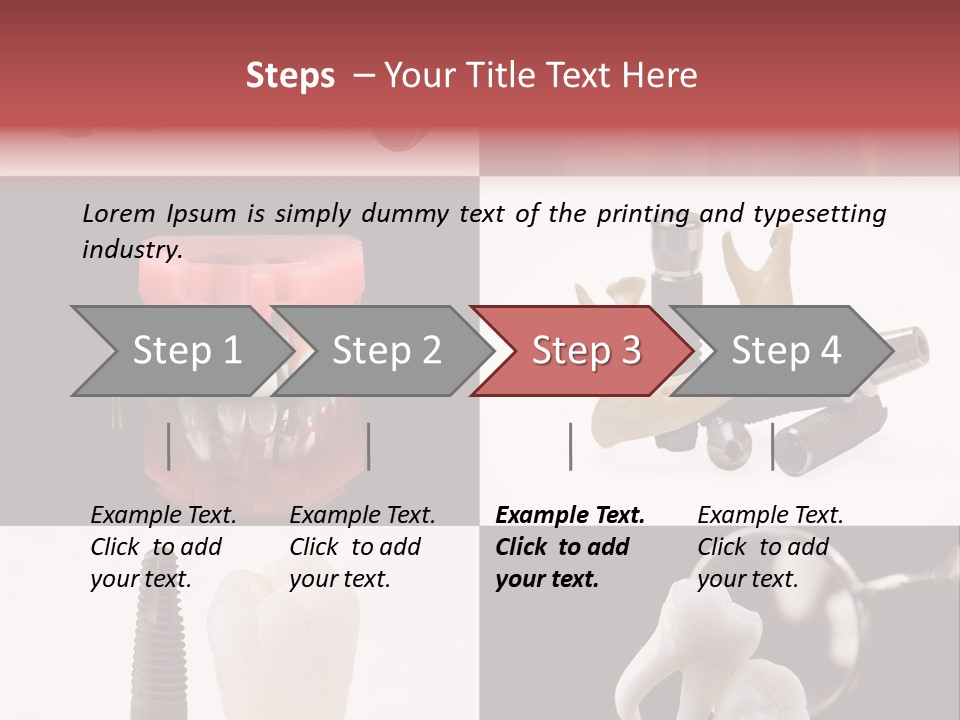 Treatment Accessory Roots PowerPoint Template