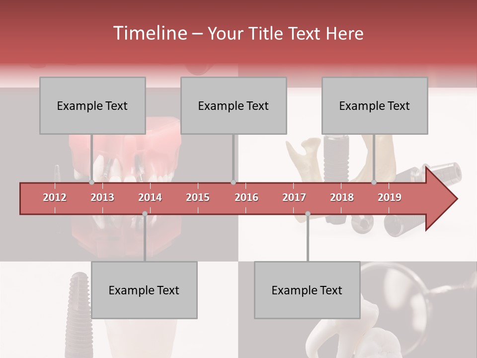 Treatment Accessory Roots PowerPoint Template