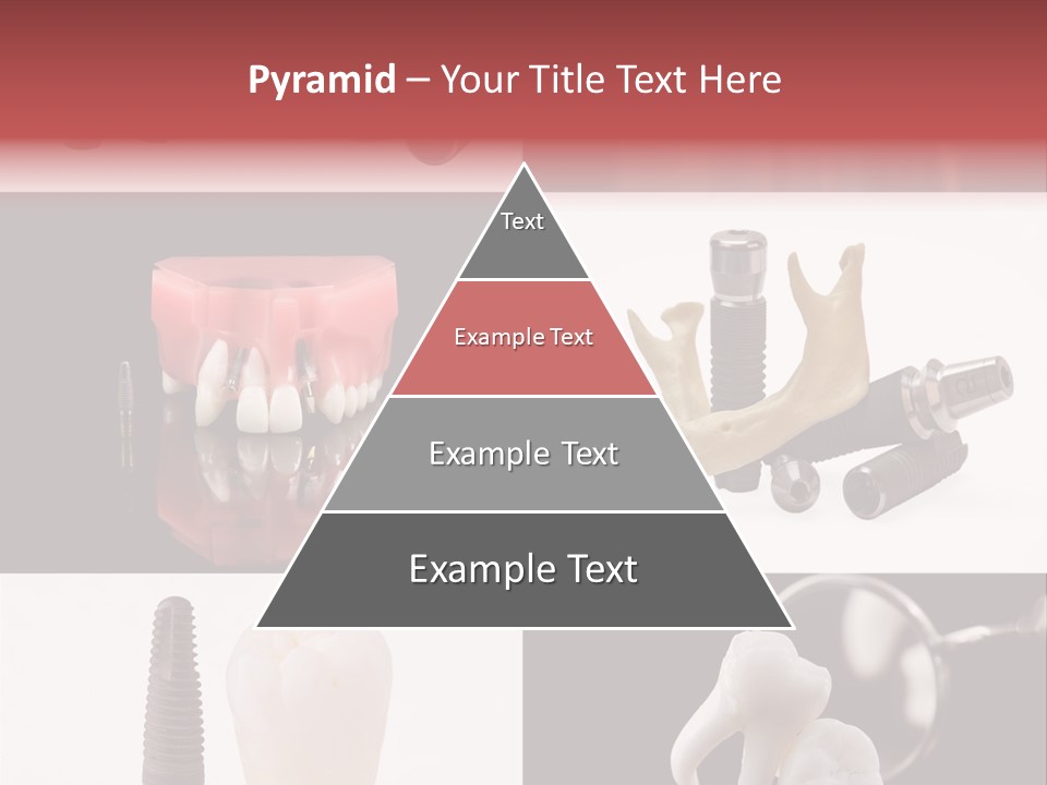 Treatment Accessory Roots PowerPoint Template