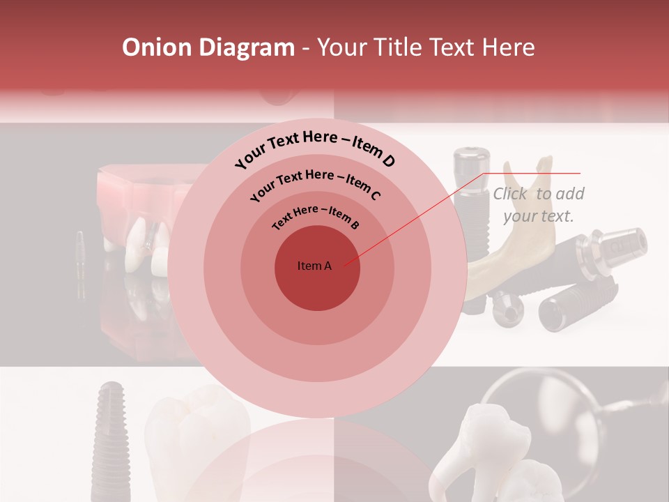 Treatment Accessory Roots PowerPoint Template