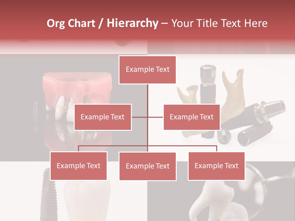 Treatment Accessory Roots PowerPoint Template