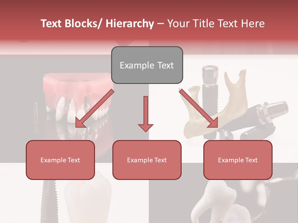 Treatment Accessory Roots PowerPoint Template