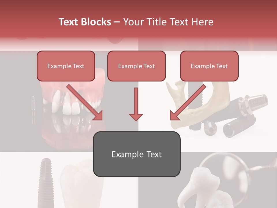 Treatment Accessory Roots PowerPoint Template