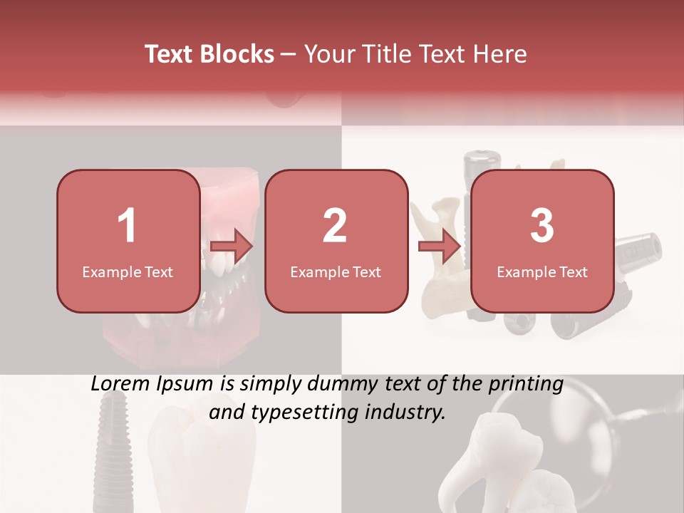 Treatment Accessory Roots PowerPoint Template