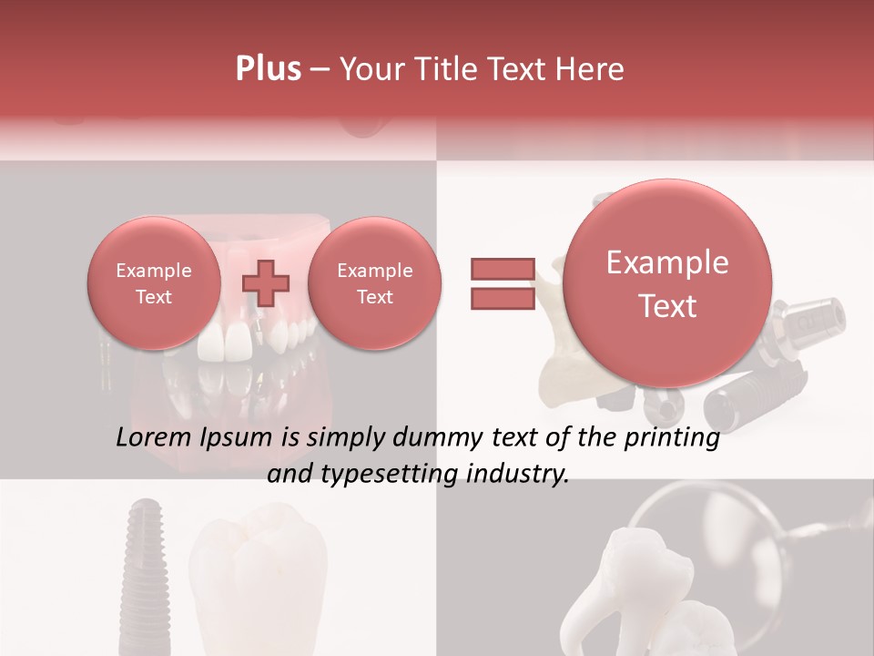 Treatment Accessory Roots PowerPoint Template