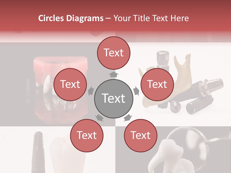 Treatment Accessory Roots PowerPoint Template