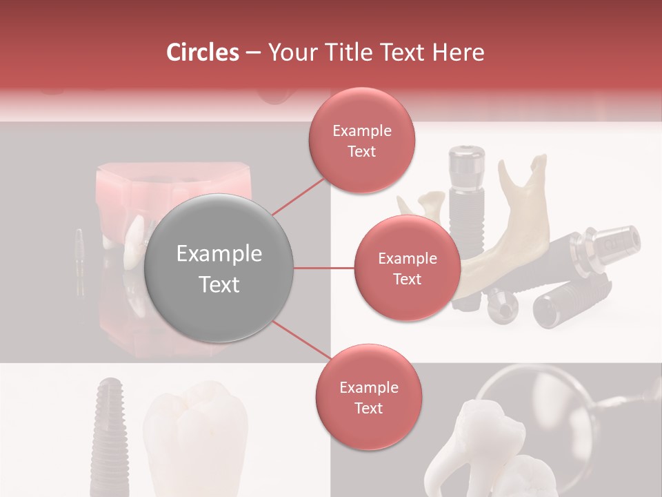 Treatment Accessory Roots PowerPoint Template