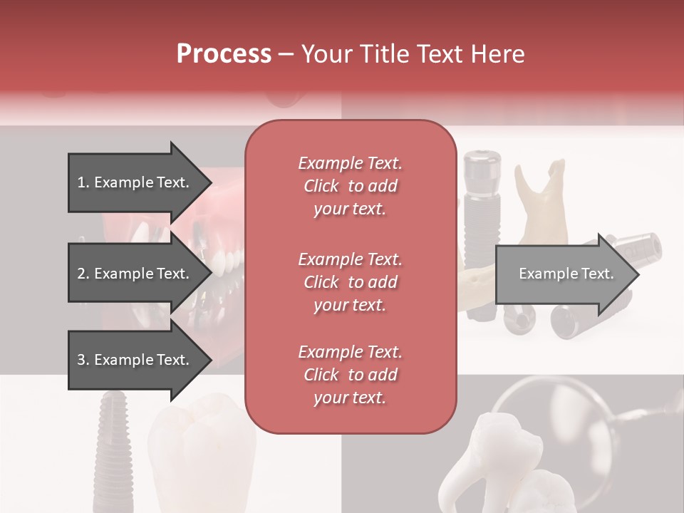 Treatment Accessory Roots PowerPoint Template