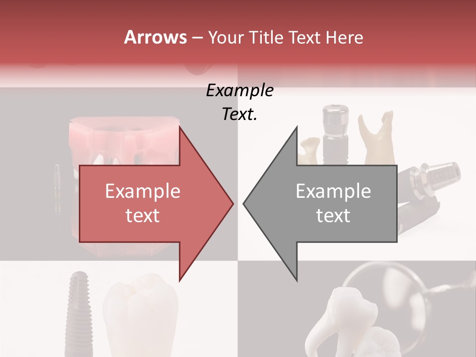 Treatment Accessory Roots PowerPoint Template