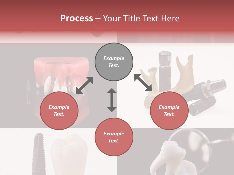 Treatment Accessory Roots PowerPoint Template