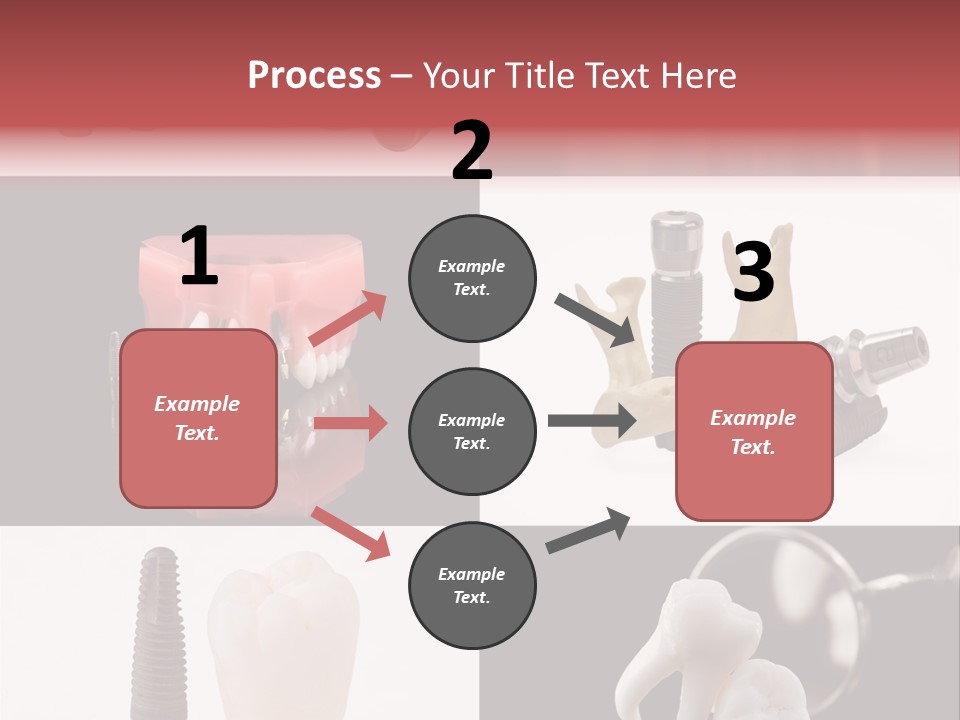 Treatment Accessory Roots PowerPoint Template