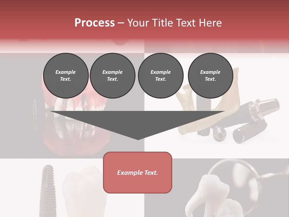 Treatment Accessory Roots PowerPoint Template