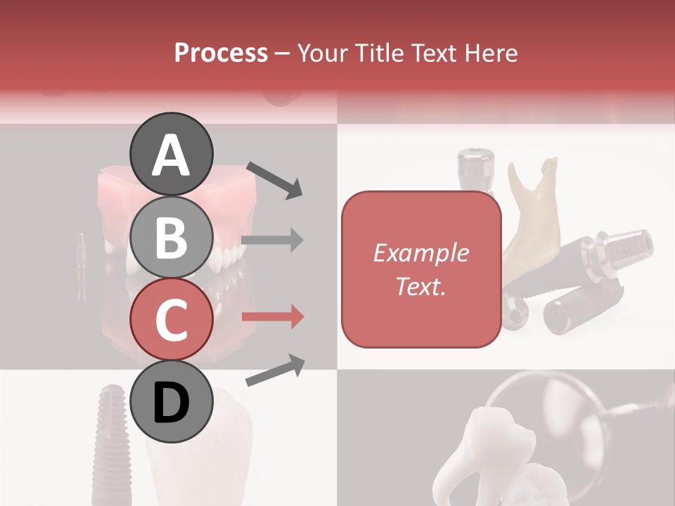 Treatment Accessory Roots PowerPoint Template