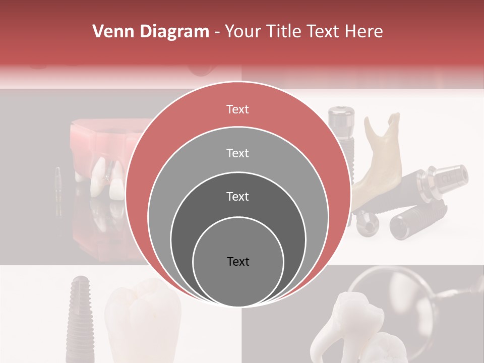 Treatment Accessory Roots PowerPoint Template