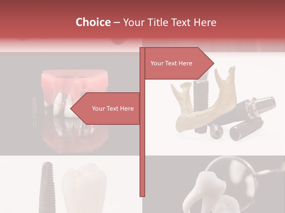 Treatment Accessory Roots PowerPoint Template