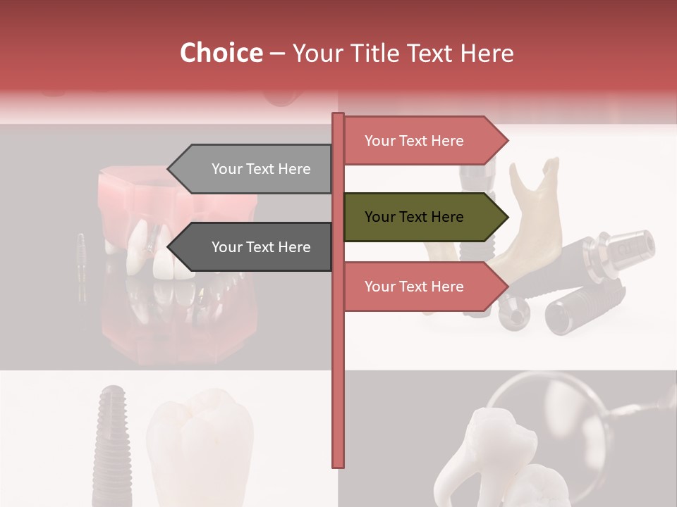 Treatment Accessory Roots PowerPoint Template