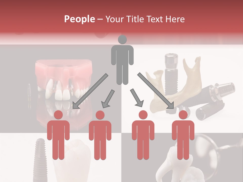 Treatment Accessory Roots PowerPoint Template