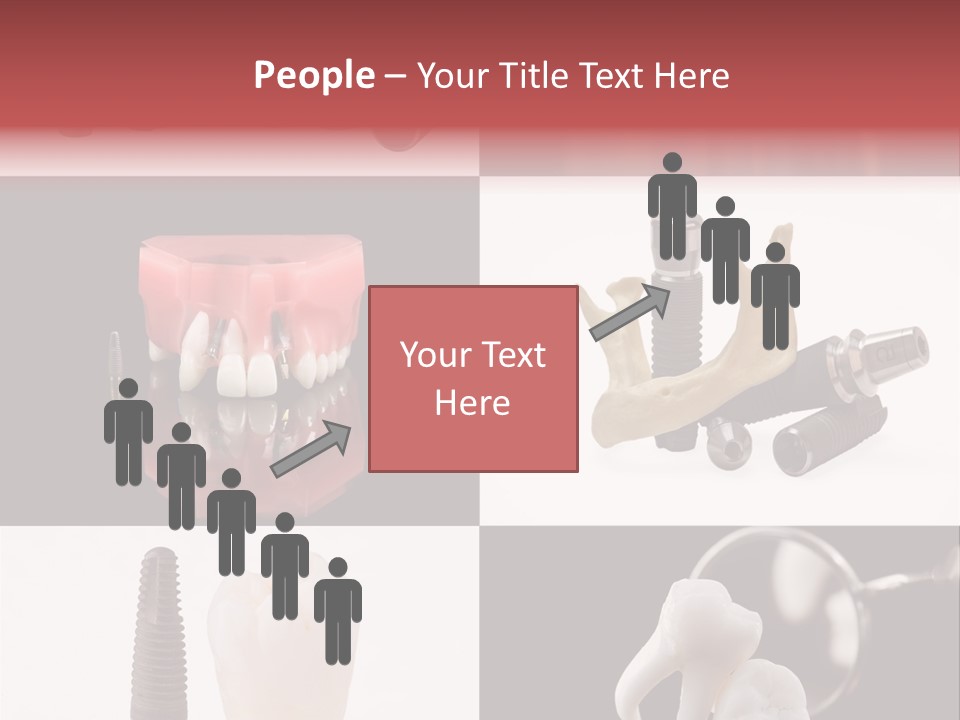 Treatment Accessory Roots PowerPoint Template