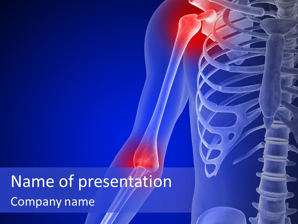 Carcass Health Elbow PowerPoint Template