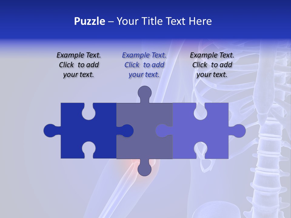 Carcass Health Elbow PowerPoint Template