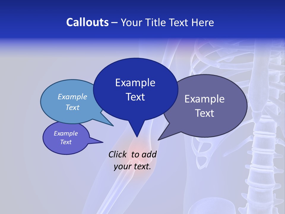 Carcass Health Elbow PowerPoint Template