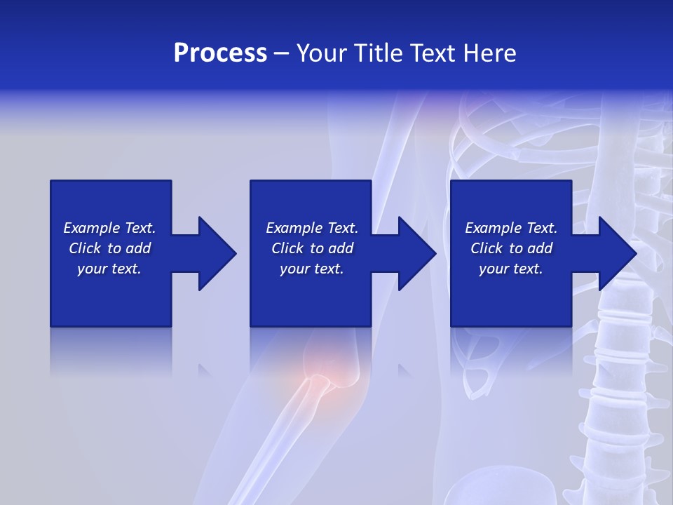 Carcass Health Elbow PowerPoint Template