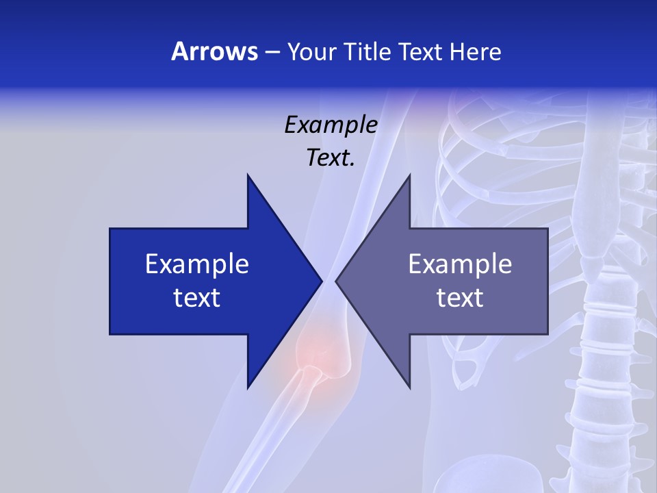 Carcass Health Elbow PowerPoint Template