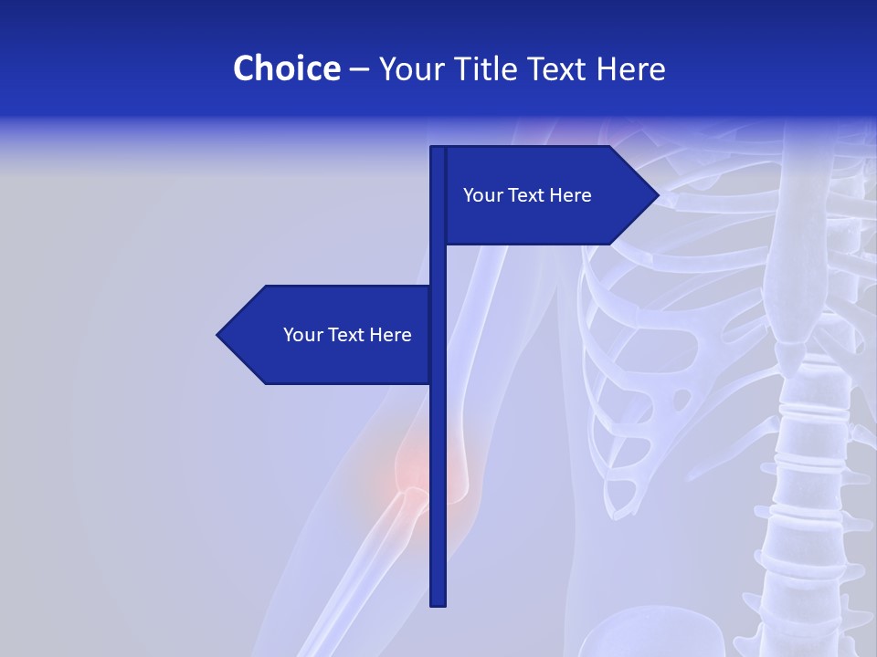 Carcass Health Elbow PowerPoint Template